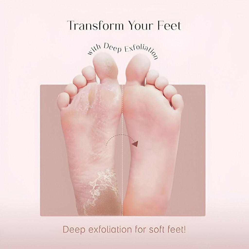 Exfoliating Foot Mask